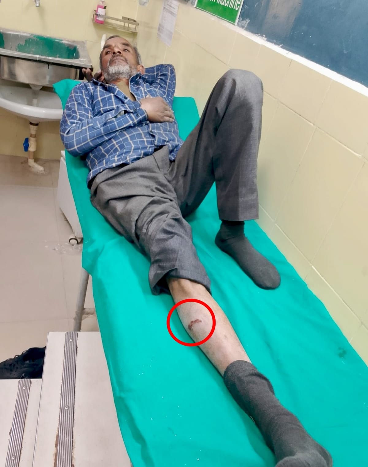 ज़ीरकपुर के ढकोली में कार मैकेनिक को आवारा कुत्ते ने काटा