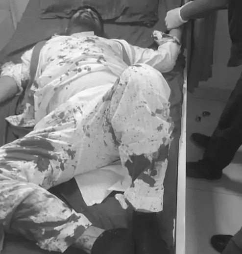 पंजाब निकाय चुनाव में 61.5% वोटिंग, कई जगह हिंसक झड़प, पुलिस-भीड़ के बीच पथराव, लाठीचार्ज, कैंडिडेट के हाथ-पैर तोड़े