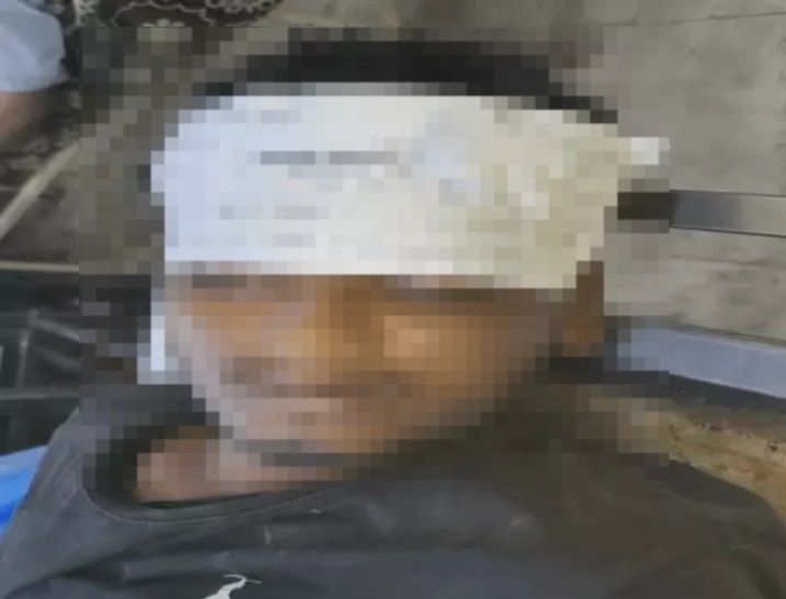 तस्कर ने शकी हालातों में फंदा लगाकर किया सुसाइड, पुलिस का कहना- गद्दे की जिप से बनाया था फंदा, जांच जारी